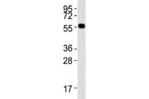 Western blot testing of PRMT3 antibody at 1:2000 dilution + mouse brain lysate; Predicted molecular weight: 55-60 kDa.