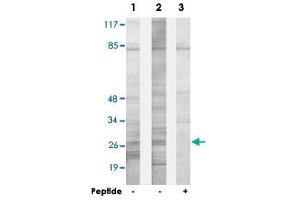 Western blot analysis of extracts from HepG2 cells (Lane 1) and HeLa cells (Lane 2 and lane 3), using SPIC polyclonal antibody . (SPIC antibody)