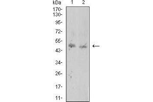 Western Blotting (WB) image for anti-ROP1 (AA 42-183) antibody (ABIN5869166) (ROP1 (AA 42-183) antibody)