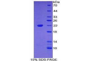 SDS-PAGE analysis of Mouse Bleomycin Hydrolase Protein. (BLMH Protein)