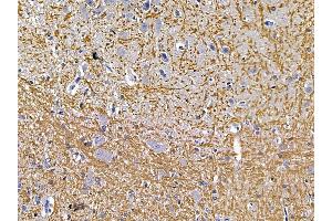 ABIN7094481 and ABIN7098530 at 1/100 staining rat brain tissue by IHC-P.