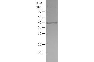 Western Blotting (WB) image for Amphiregulin (AREG) (AA 101-198) protein (His-IF2DI Tag) (ABIN7282019) (Amphiregulin Protein (AREG) (AA 101-198) (His-IF2DI Tag))