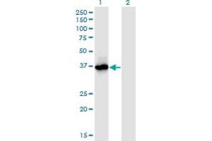 Western Blot analysis of PRMT6 expression in transfected 293T cell line by PRMT6 monoclonal antibody (M02), clone 3C3. (PRMT6 antibody  (AA 1-316))