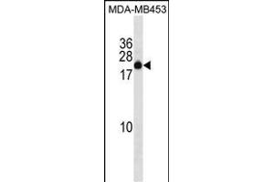 ZN Antibody (C-term) (ABIN1536745 and ABIN2850068) western blot analysis in MDA-M cell line lysates (35 μg/lane). (ZNF747 antibody  (C-Term))