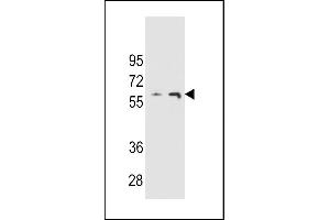 THUM3 Antibody (Center) (ABIN654774 and ABIN2844455) western blot analysis in  and  cell line lysates (35 μg/lane). (THUMPD3 antibody  (AA 194-223))