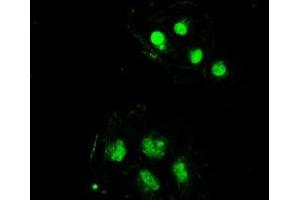 Image no. 16 for anti-Sjogren Syndrome Antigen B (SSB) antibody (ABIN1501146)