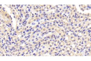 Immunohistochemistry (IHC) image for anti-Cathepsin D (CTSD) (AA 66-410) antibody (ABIN7433375)