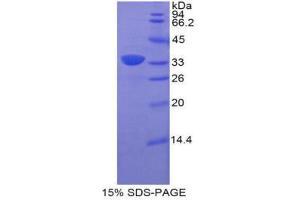 SDS-PAGE (SDS) image for Bone Marrow Stromal Cell Antigen 1 (BST1) (AA 41-300) protein (His tag) (ABIN2124140) (BST1 Protein (AA 41-300) (His tag))