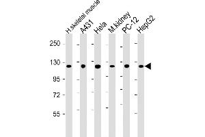 All lanes : Anti-Vinculin at 1:2000 dilution Lane 1: human skeletal muscle lysate Lane 2: A431 whole cell lysate Lane 3: Hela whole cell lysate Lane 4: mouse kidney lysate Lane 5: PC-12 whole cell lysate Lane 6: HepG2 whole cell lysate Lysates/proteins at 20 μg per lane. (Vinculin antibody  (AA 634-668))