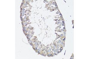 Immunohistochemistry of paraffin-embedded mouse testis using MRP4/ antibody (ABIN3023192, ABIN3023193, ABIN3023194 and ABIN6219432) at dilution of 1:150 (40x lens).