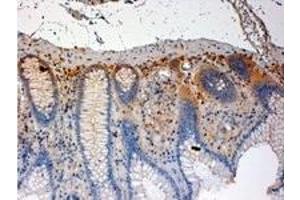 Image no. 3 for anti-C-Src tyrosine Kinase (CSK) (C-Term) antibody (ABIN374096) (CSK antibody  (C-Term))
