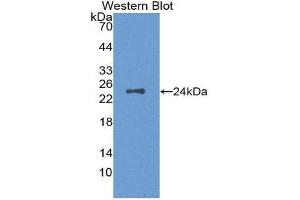 Western Blotting (WB) image for anti-Colony Stimulating Factor 1 (Macrophage) (CSF1) (AA 33-204) antibody (ABIN1869132)