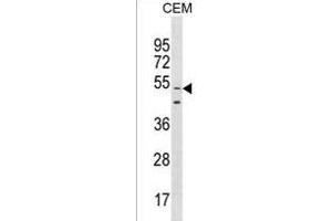 GOLGA6L9 Antibody (N-term) (ABIN1539058 and ABIN2850032) western blot analysis in CEM cell line lysates (35 μg/lane). (GOLGA6L9 antibody  (N-Term))