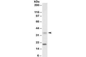 Western blot testing of mouse spleen lysate with HOXA9 antibody at 2ug/ml. (HOXA9 antibody)