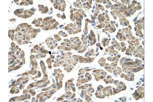 Immunohistochemistry (IHC) image for anti-Sialidase 1 (Lysosomal Sialidase) (NEU1) (Middle Region) antibody (ABIN2781801) (NEU1 antibody  (Middle Region))