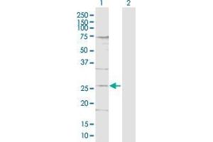 Lane 1: DDIT4L transfected lysate ( 21. (DDIT4L 293T Cell Transient Overexpression Lysate(Denatured))