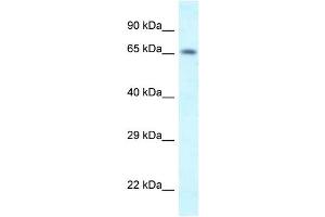 WB Suggested Anti-Shkbp1 Antibody   Titration: 1. (SHKBP1 antibody  (N-Term))