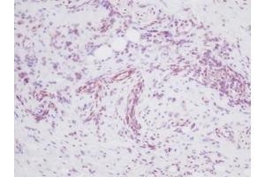 Image no. 3 for anti-Melanoma Inhibitory Activity (MIA) antibody (ABIN464852) (MIA antibody)