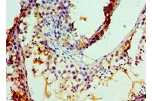 Immunohistochemistry of paraffin-embedded human testis tissue using ABIN7148465 at dilution of 1:100 (COG7 antibody  (AA 511-770))