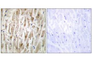 Immunohistochemistry analysis of paraffin-embedded human heart tissue using LIMK2 antibody. (LIMK2 antibody  (Internal Region))