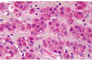 Human Adrenal: Formalin-Fixed, Paraffin-Embedded (FFPE) (SMAD3 antibody  (AA 100-150))