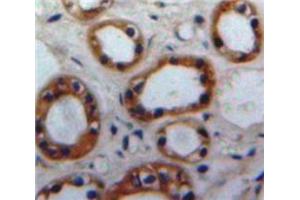 Used in DAB staining on fromalin fixed paraffin-embedded Kidney tissue (Nischarin antibody  (AA 1335-1435))
