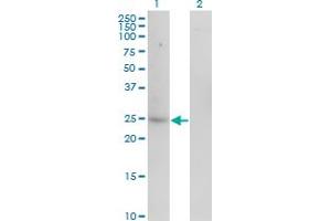 Western Blot analysis of CA1 expression in transfected 293T cell line by CA1 monoclonal antibody (M07), clone 7G12. (CA1 antibody  (AA 1-261))