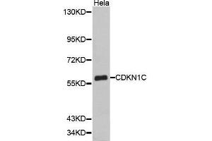 Western Blotting (WB) image for anti-Cyclin-Dependent Kinase Inhibitor 1C (p57, Kip2) (CDKN1C) (AA 1-100) antibody (ABIN1512749) (CDKN1C antibody  (AA 1-100))
