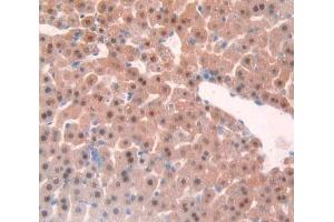IHC-P analysis of liver tissue, with DAB staining. (TNFRSF1A antibody  (AA 239-433))