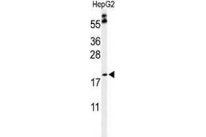 Western blot analysis of PXMP2 (arrow) in HepG2 cell line lysates (35ug/lane) using PXMP2  (PXMP2 antibody  (Middle Region))