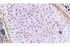 Immunohistochemistry (IHC) image for anti-Fibromodulin (FMOD) (AA 19-376) antibody (ABIN7433693)