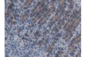 Detection of ABCC11 in Rat Stomach Tissue using Polyclonal Antibody to ATP Binding Cassette Transporter C11 (ABCC11) (ABCC11 antibody  (AA 1127-1366))