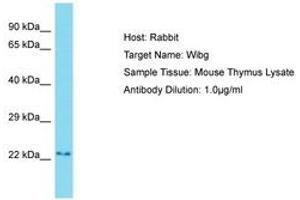 Image no. 1 for anti-Partner of Y14 and mago (WIBG) (AA 81-130) antibody (ABIN6750448) (PYM antibody  (AA 81-130))