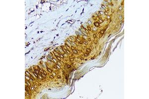 Immunohistochemistry (IHC) image for anti-Keratin 1 (KRT1) antibody (ABIN7268085)