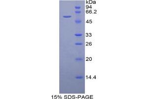 SDS-PAGE analysis of Mouse DARC Protein. (DARC Protein)