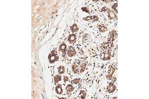 Immunohistochemical analysis of paraffin-embedded human breast tissue using C performed on the Leica® BOND RXm. (ALOXE3 antibody  (AA 223-252))