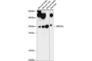 Western blot analysis of extracts of various cell lines, using SRD5 antibody (4787) at 1:1000 dilution. (SRD5A1 antibody  (AA 100-200))