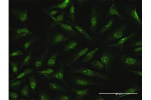 Immunofluorescence of purified MaxPab antibody to CDC6 on HeLa cell.