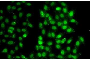 PSMD8 antibody