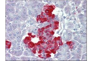 Pancreas, Human: Formalin-Fixed, Paraffin-Embedded (FFPE) (PDGFB antibody  (C-Term))