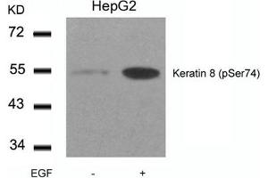 Western blot analysis of extracts from HepG2 cells untreated or treated with EGF using Keratin 8(Phospho-Ser74) Antibody. (KRT8 antibody  (pSer74))