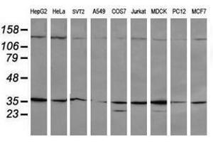 Image no. 4 for anti-Mitogen-Activated Protein Kinase Kinase 3 (MAP2K3) antibody (ABIN1499400)