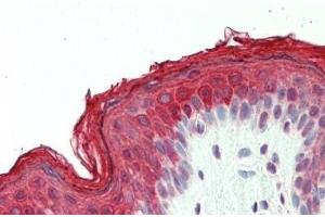 Human, Skin: Formalin-Fixed Paraffin-Embedded (FFPE) (DNAJB1 antibody  (AA 74-123))