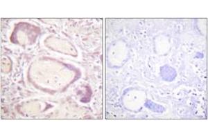 Immunohistochemistry analysis of paraffin-embedded human placenta, using Cyclin B1 (Phospho-Ser147) Antibody. (Cyclin B1 antibody  (pSer147))
