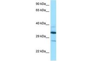 Image no. 1 for anti-Deoxyhypusine Hydroxylase/monooxygenase (DOHH) (AA 63-112) antibody (ABIN6748094) (DOHH antibody  (AA 63-112))