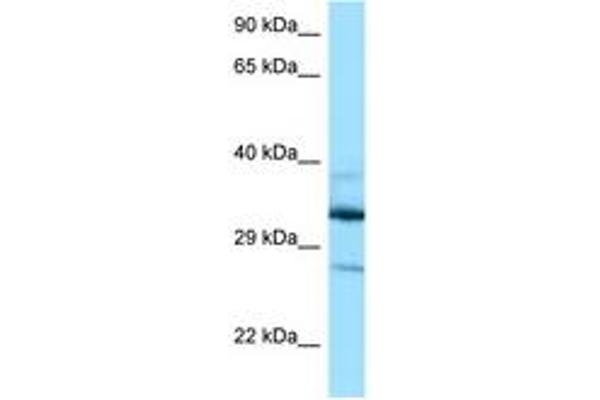 DOHH anticorps  (AA 63-112)