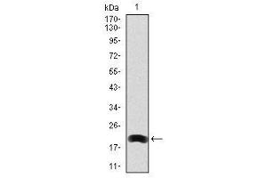 Image no. 1 for anti-Low Density Lipoprotein Receptor-Related Protein 5 (LRP5) antibody (ABIN1499194)