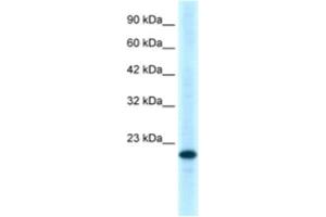 Western Blotting (WB) image for anti-Tumor Necrosis Factor Receptor Superfamily, Member 18 (TNFRSF18) antibody (ABIN2463662) (TNFRSF18 antibody)