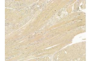 ABIN6265947 and ABIN6277546 at 1/100 staining human tongue carcinoma by IHC-P. (VAPB antibody  (C-Term))