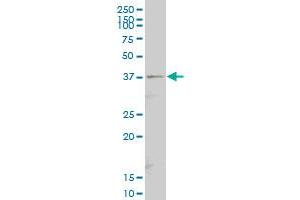 Septin 9 antibody  (AA 26-125)